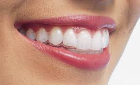 Orthodontie